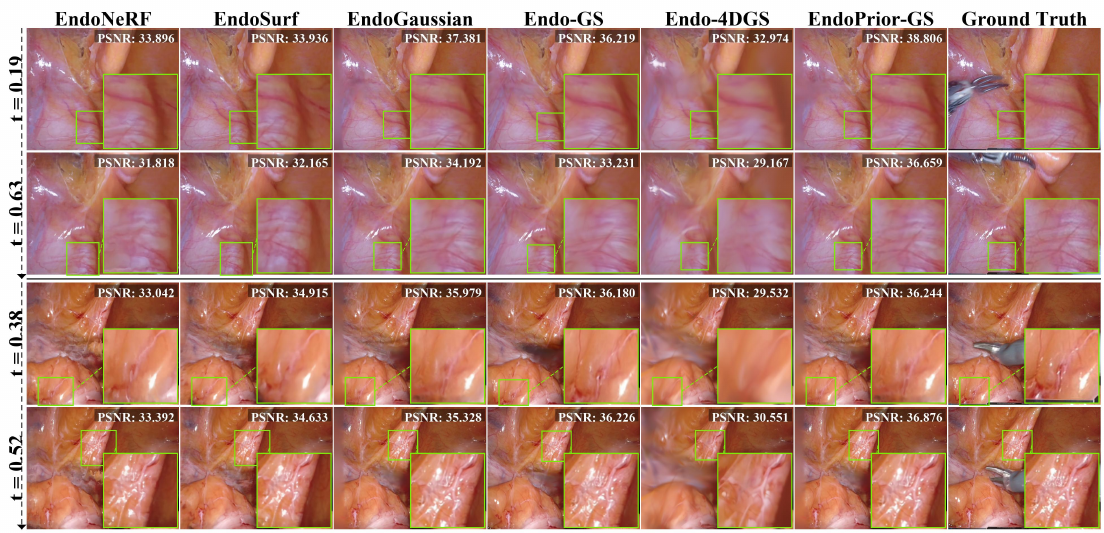 Qualitative comparison with state-of-the-art endoscopic reconstruction methods